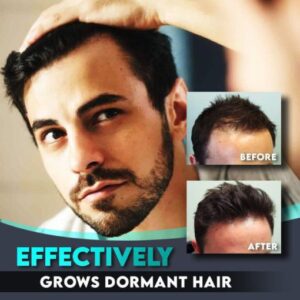 Hair Regrowth Roller and Essence Set