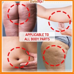 BurnUp! Ultimate Cellulite Heating Spray