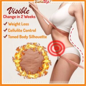 BurnUp! Ultimate Cellulite Heating Spray