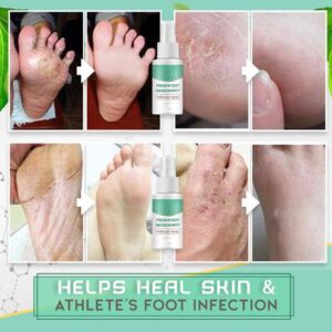 FreshFoot Deodorant Antifungal Spray