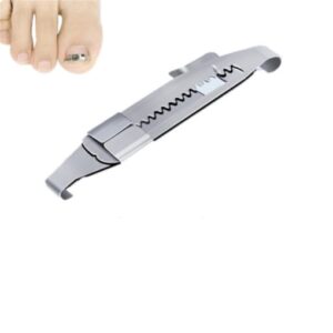 Toenails Correction Stainless Steel Clip Buckle