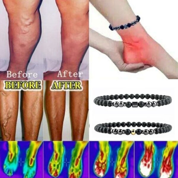 Anti Varicose And Swelling Magnetotherapy Anklet