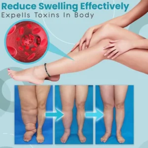 Anti Varicose And Swelling Magnetotherapy Anklet