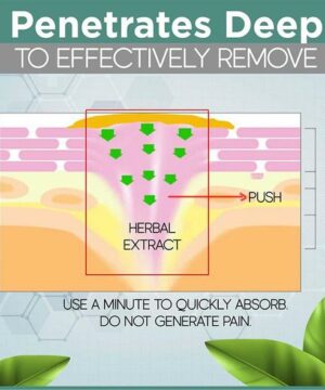 Corn Removal Extra Strengthen Gel
