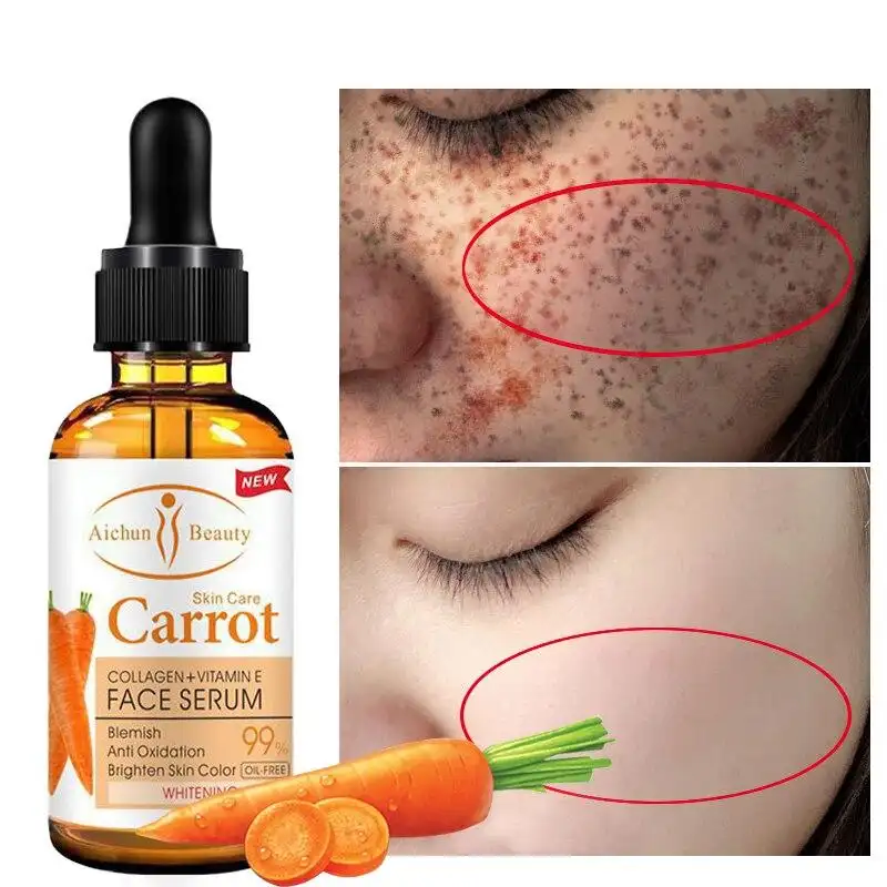 Dark Spot Corrector Whitening Natural Serum