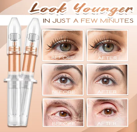 Eye Bags Instant Removal Cream