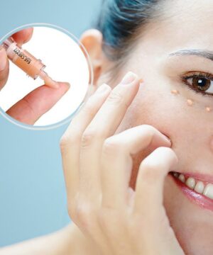 Eye Bags Instant Removal Cream