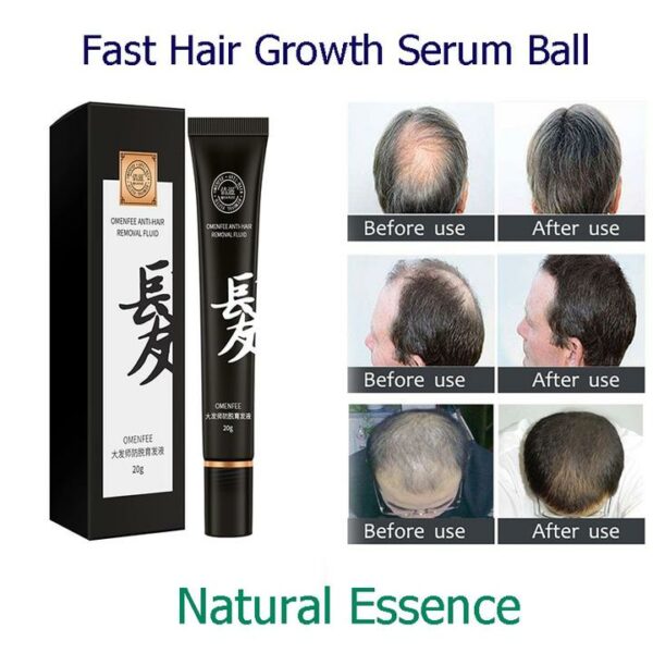 Herbal Hair Reboost Roll-On Massage Serum