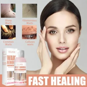 Herbal Wart Skin Removal Ointment