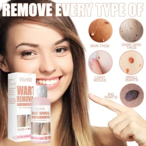Herbal Wart Skin Removal Ointment