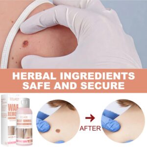Herbal Wart Skin Removal Ointment