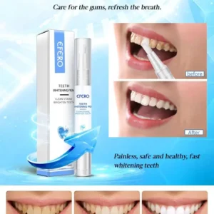 Instant Brightify Oral Tooth Pen