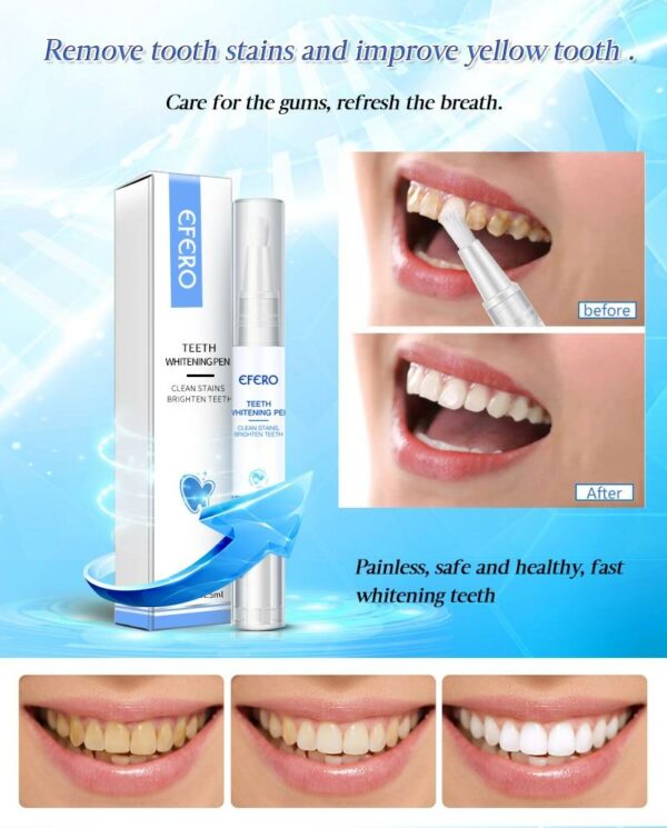 Instant Brightify Oral Tooth Pen