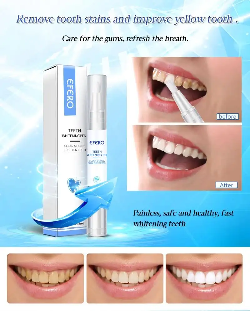 Instant Brightify Oral Tooth Pen