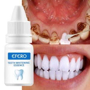 Instant Brightify Oral Tooth Pen