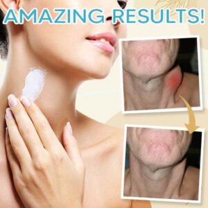 Lymphatic Herbal Detoxification Cream