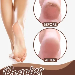 Natural Horse Oil Foot Repair Cream