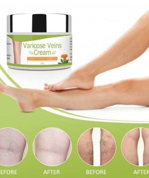 Organic Varicose Vein Healing Cream