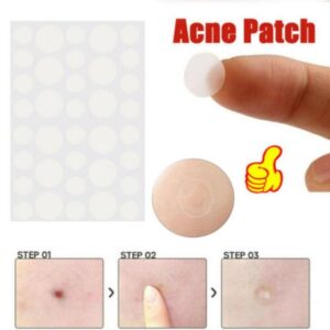 SkinTag Organic RemoverPatch