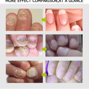 Toe Be Health Instant Beauty Gel