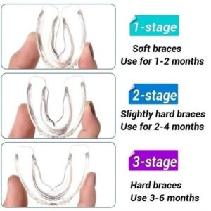 Tooth Orthodontic Braces