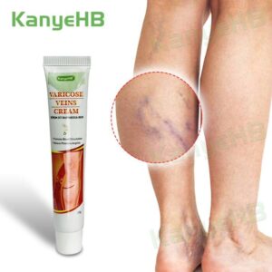 Varicose Veins Miracle Cream