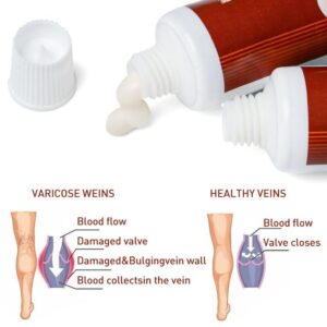 Varicose Veins Miracle Cream