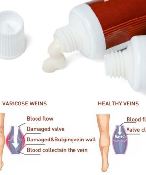 Varicose Veins Miracle Cream