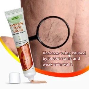 Varicose Veins Miracle Cream