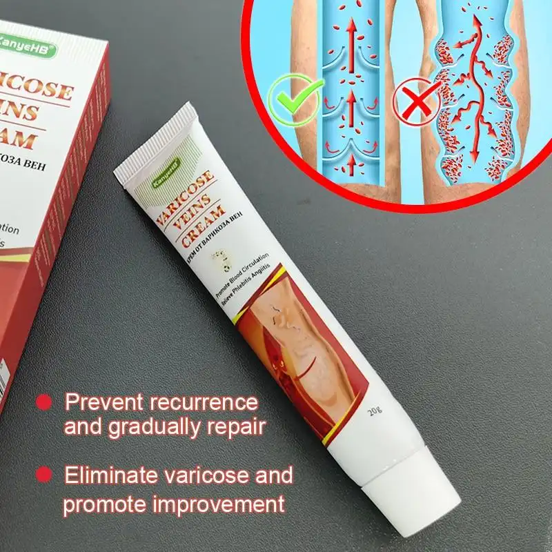 Varicose Veins Miracle Cream