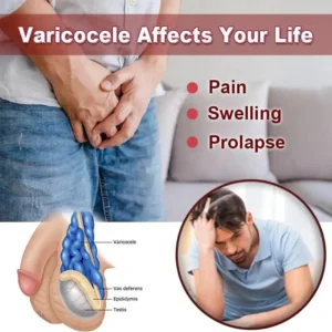 Varicose Veins Miracle Cream