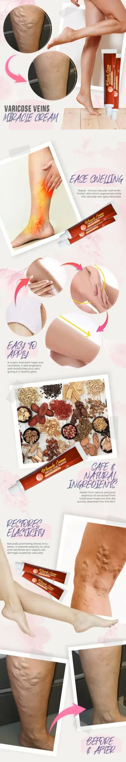 Varicose Veins Miracle Cream