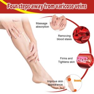 Varicose Veins Miracle Cream