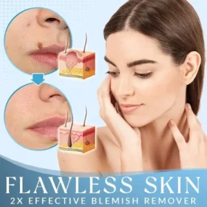 Derma'Pro Mole & Wart Remove Treatment Set