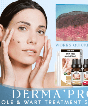 Derma'Pro Mole & Wart Remove Treatment Set