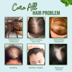 FastGrow HealthyHair Spray