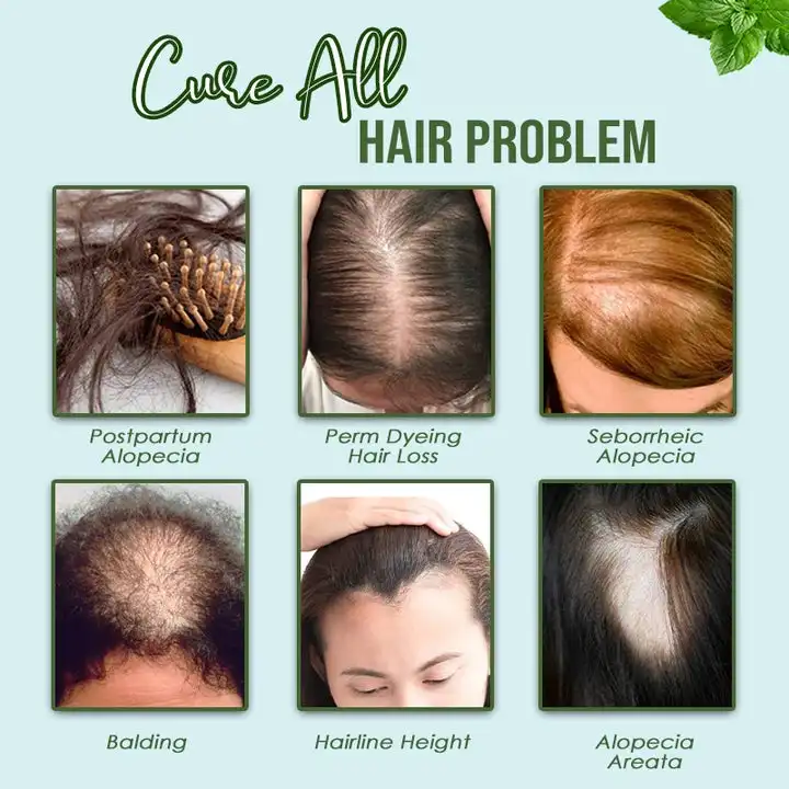 FastGrow HealthyHair Spray