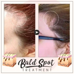 Hair Boost Ginger Cream