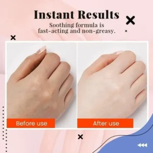 Hyaluronic Acid Hand Care Essence