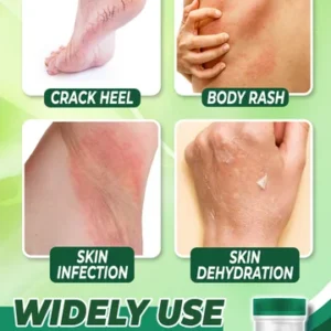 Organic Herbal Tinea Corporis Cream