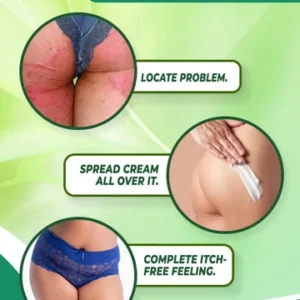 Organic Herbal Tinea Corporis Cream