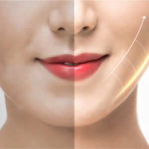 Anti-Aging Facelift Gürtel