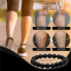 Black AntiSwelling ObsidianAnklet