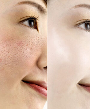 HISEES Shrink Pores Anti-Aging Collagen Whitening Face Cream
