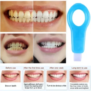 Nano Teeth Whitening Kit