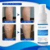 Organic AntiVaricose MiracleSpray