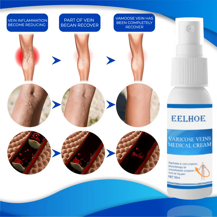 Organic AntiVaricose MiracleSpray - Image 5