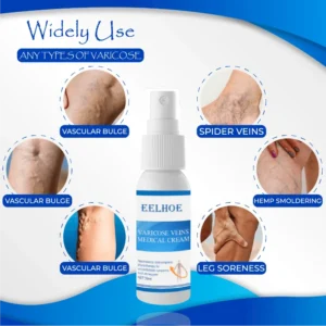 Organic AntiVaricose MiracleSpray