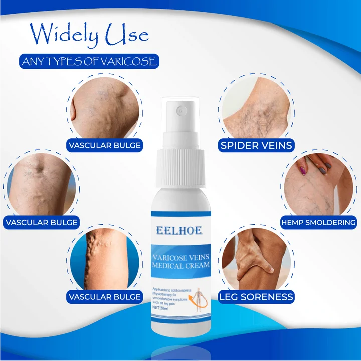 Organic AntiVaricose MiracleSpray