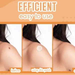 Skin Tag Removal Patches